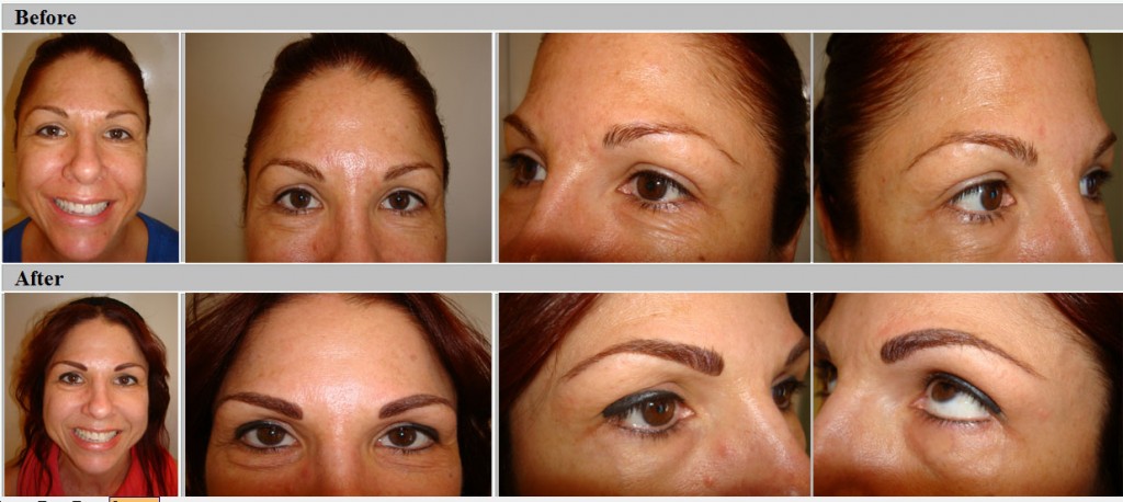 Eyebrows before and after