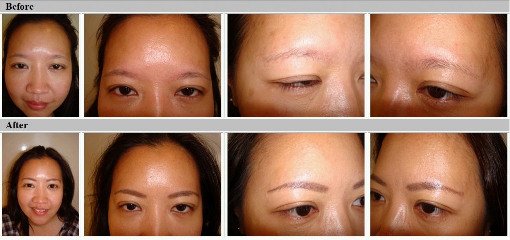 Eyebrows, before and after