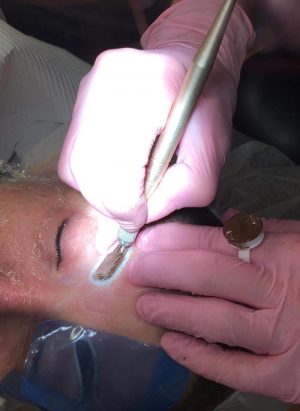 Diane doing Eyebrow Microstroking, her newest eyebrow procedure