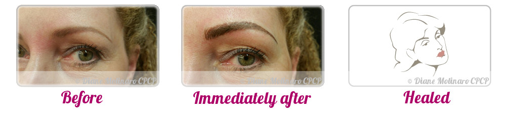 Single Needle – Hair Stroke Brows - Left view