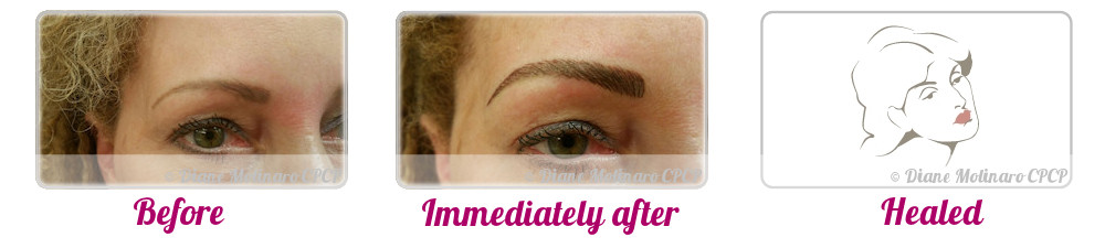 Single Needle – Hair Stroke Brows - Right view